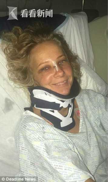 女子登山从15米高岩石摔落满脸是血 微笑拍照浑然不知脖子断了