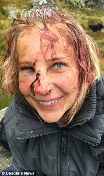 女子登山从15米高岩石摔落满脸是血 微笑拍照浑然不知脖子断了