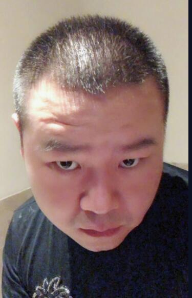 小岳岳晒照心疼头发,网友:赶个潮流,再秃点就成心形发际线了|岳云鹏