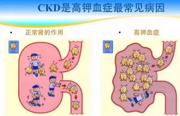 遇见高钾血症必须要做这些