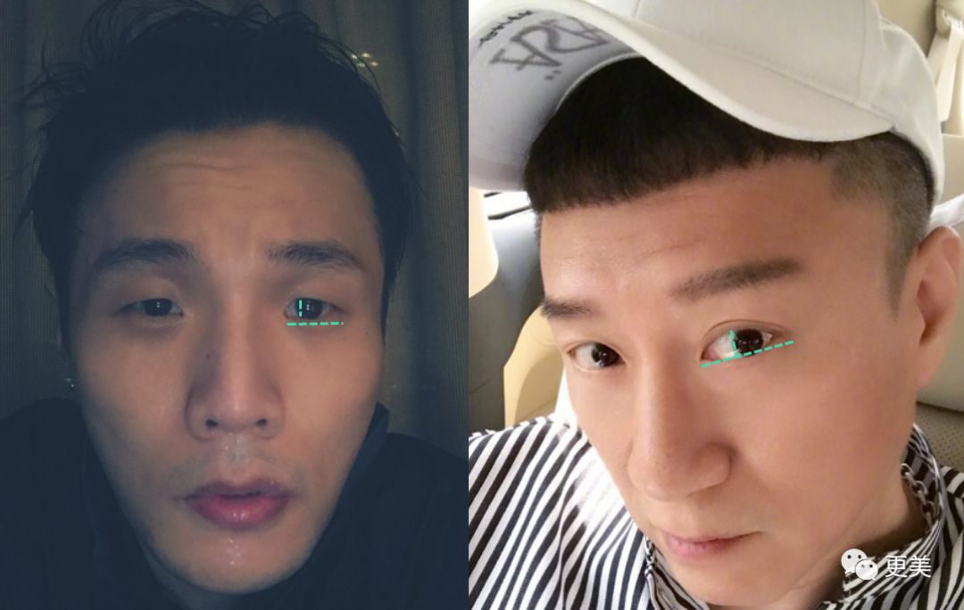 其实眼睛睁开后也比李荣浩的大很多.