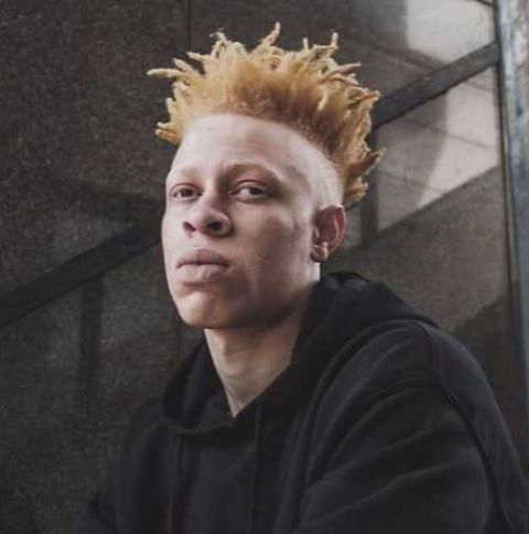 白化病男孩从小被同伴欺凌 长大后成为人人羡慕的模特