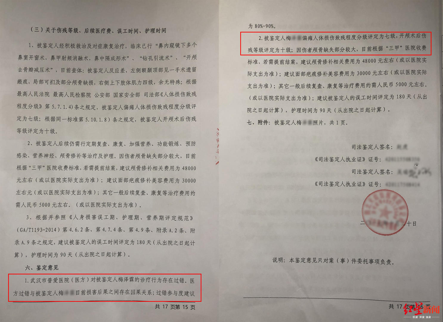 武汉大学生因鼻窦炎手术致智力障碍 家长医院陷赔偿僵局