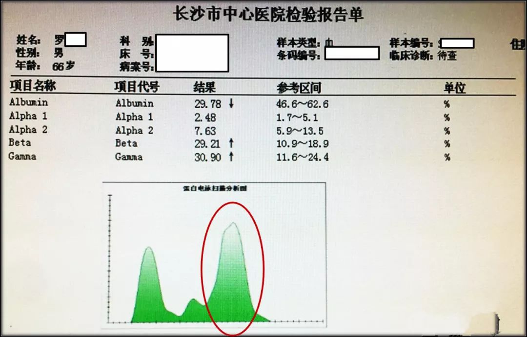 "m"字的研究,一例总蛋白异常引发的疑案