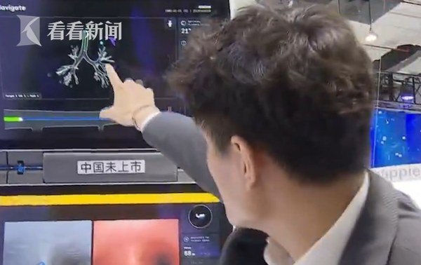 达芬奇xi手术机器人医生的得力助手