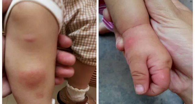 预告| 夏日蚊子来袭,怎样有效驱蚊才安全靠谱?用这2款就够了