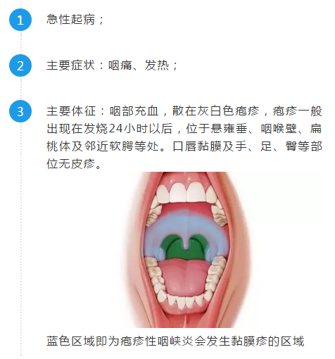 传染性强!中山已有多名儿童中招!什么病这么厉害?