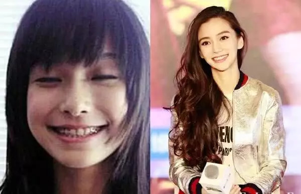 的模样其实也很漂亮小s早在出道之际就矫正了牙齿她们变美的过程中