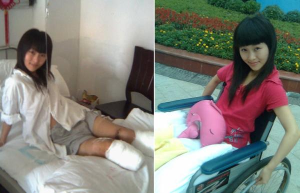 汶川十年记(上)廖智:我失去双腿,却找到更好的人生|婆婆|廖智|痛苦