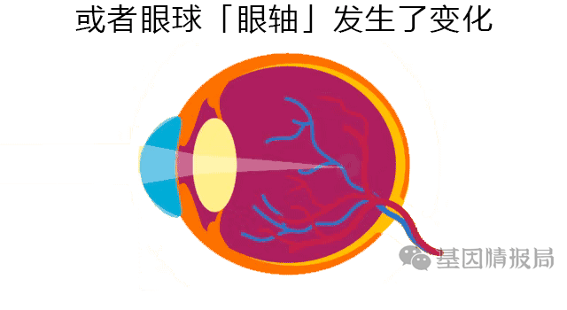 不戴眼镜,不开刀做手术,也能永久治好近视!