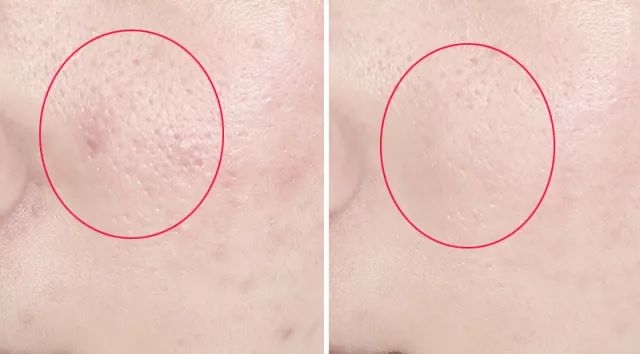 卸妆液界的神仙水,30秒卸防水妆,连洁面护肤也一次性搞定