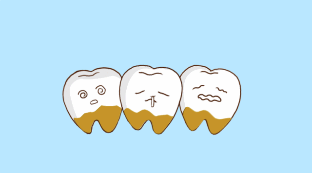 二 如何应对牙结石?