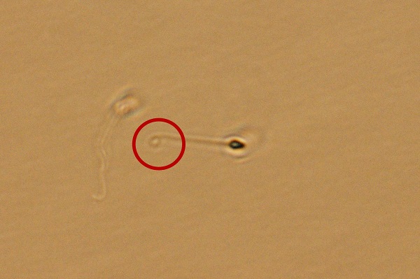 卵子透明带上打孔的低能量激光,在显微镜下对静止的"小蝌蚪"一一射击