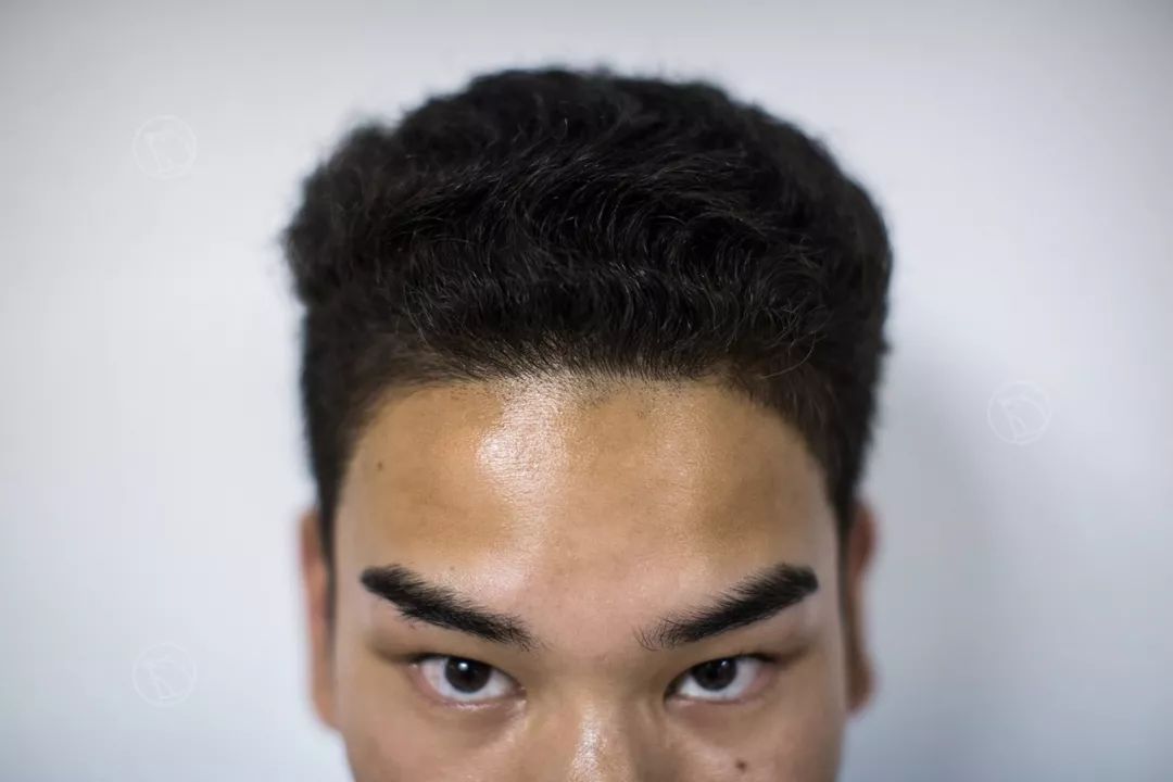 发际线男孩小吴:出名90天