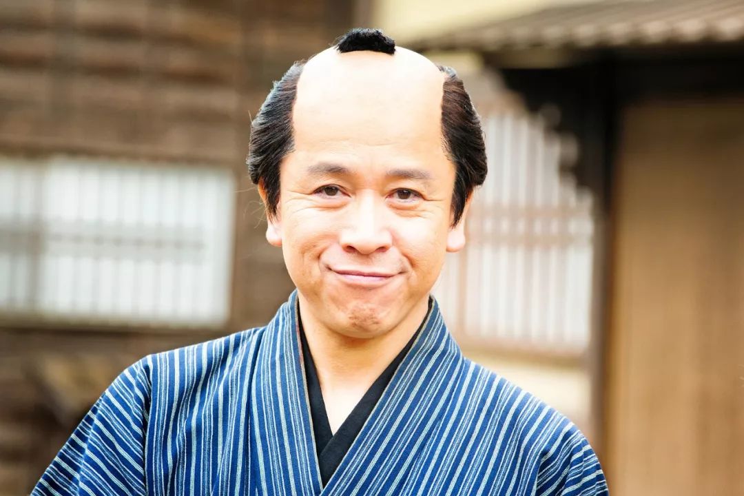 我,94 年生,秃了,2 万块植了个发