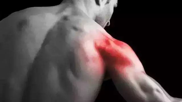 这种现象有个专业名称叫“延迟性肌肉酸痛”。