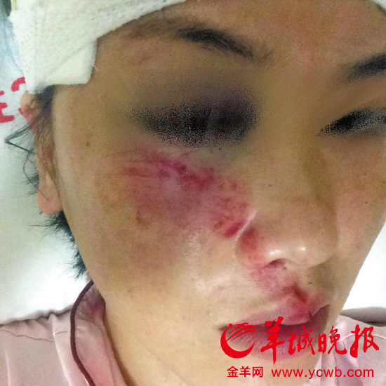 歹徒潜入车内 女车主被砖块爆头