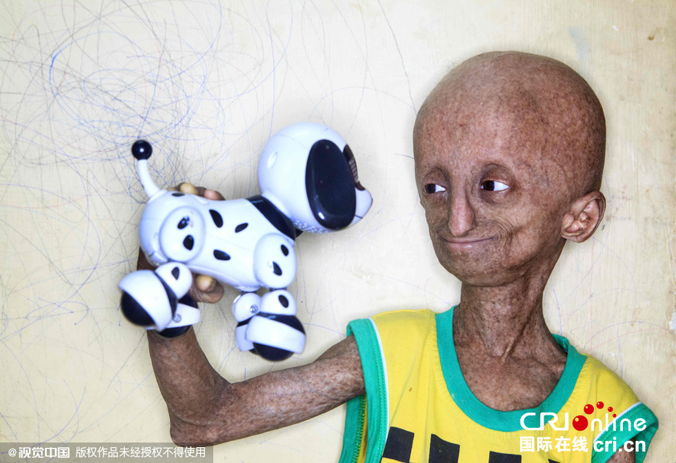 消息,据英国《每日邮报》报道,印度孟买的14岁男孩尼哈尔·比策(nihal