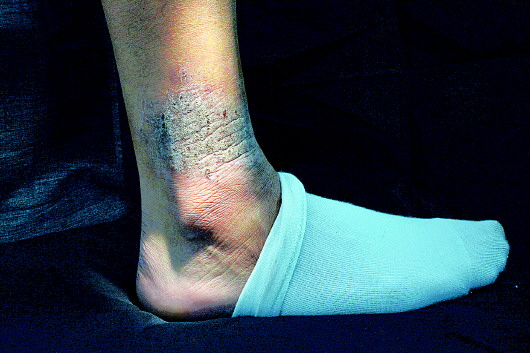 "毒疤"|吸毒|济宁|吸毒史_新浪新闻