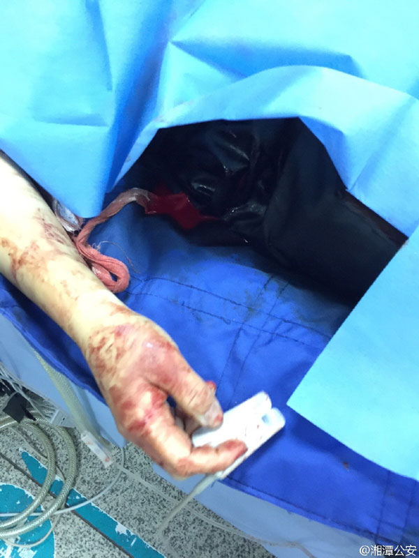 湘潭一疑似精神病患者砍伤路人民警被捅身亡组图