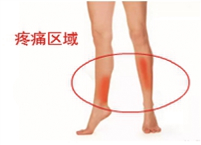 怎么解决跑步引起的小腿疼痛问题