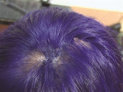 经常来染发的双胞胎姐妹.姐姐的头发染后掉了不少.方龙 摄