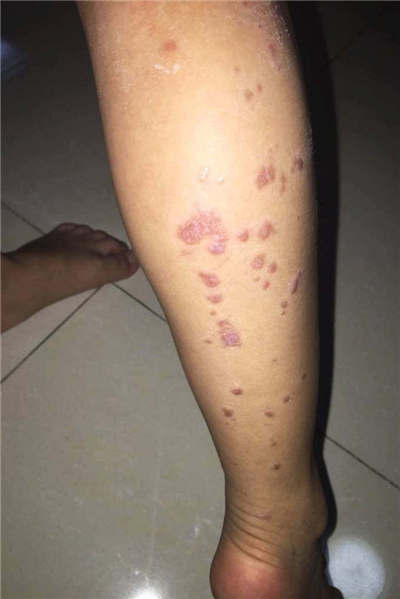 幼儿园让孩子睡发霉地板 身下蟑螂白蚁遍地(图)