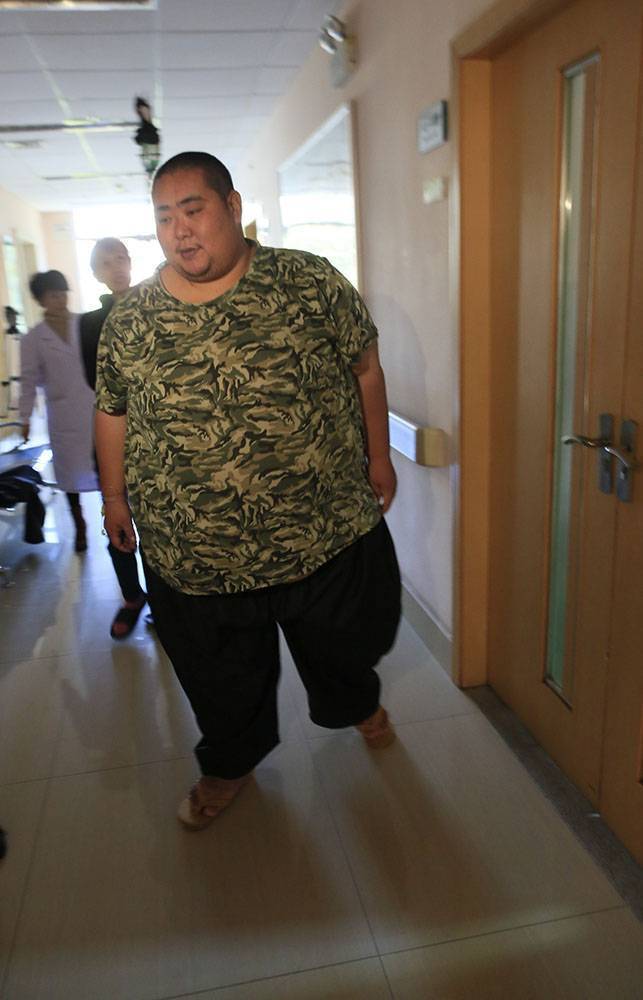 清远汉子成中国第一胖妻子认为结扎是一个转折点