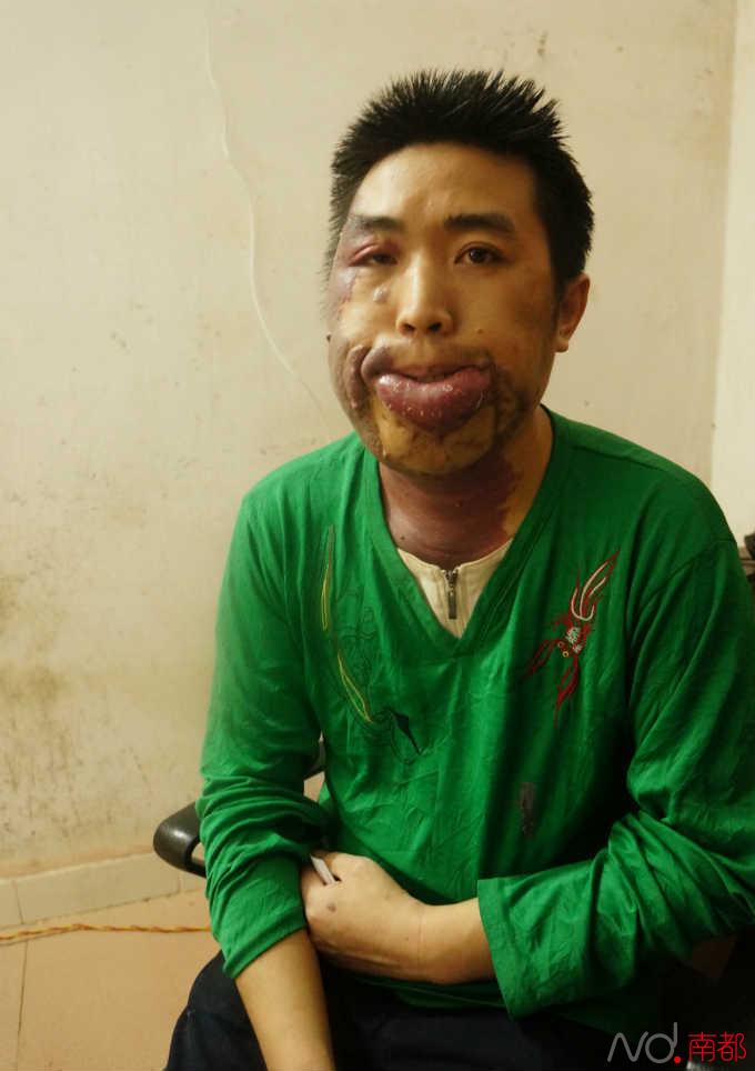 【南都语闻】舒科的困境