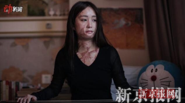 探访:花季少女被"官二代"毁容五年后生活