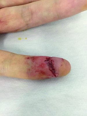 醉汉急救车上殴打咬伤医生被打医生未敢还手