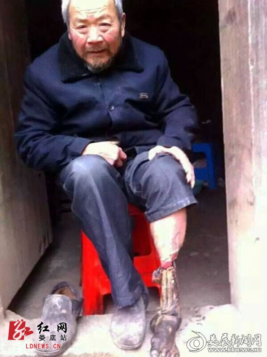 娄底媒体与社会力量爱心接力 七旬孤寡老人获"新生"