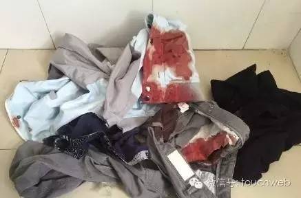 震惊！电竞选手搭滴滴，被司机砍断手筋