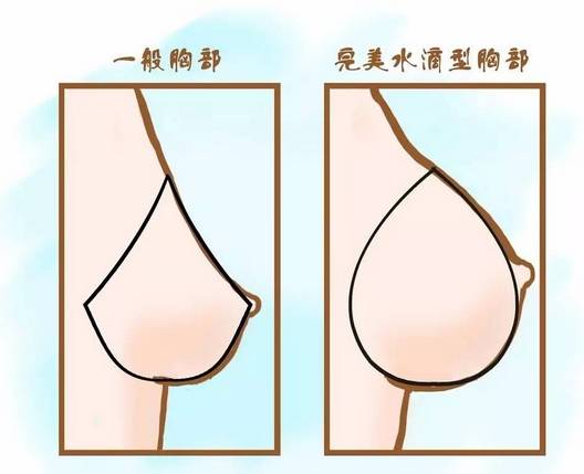 最完美的乳房外形当属如同"米洛的维纳斯"一样的半球型水滴状双胸.