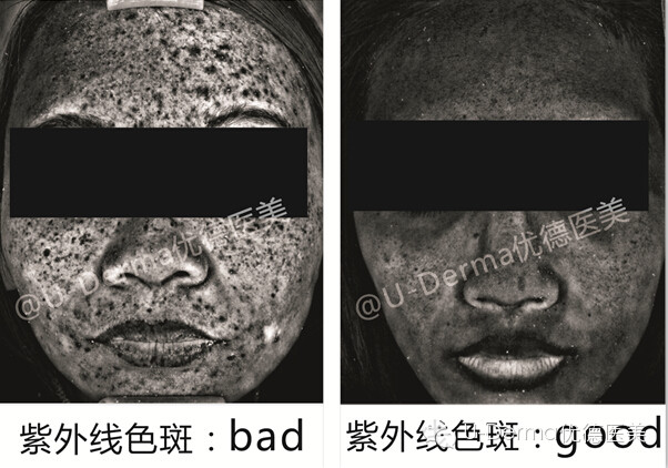 把里面的色素点说成是重金属残留,告诉你要排毒,不排毒脸会怎么怎么滴