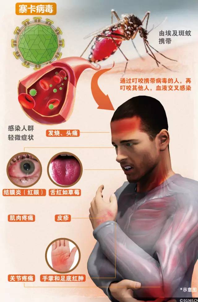 注意 | 寨卡病毒疫情扩散至新加坡马来西亚 已有21名中国人感染_新浪财经_新浪网