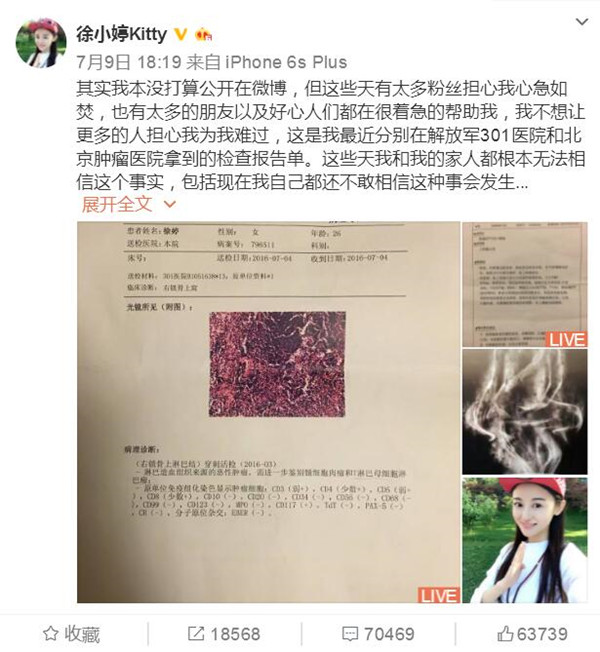 近日,90后女演员徐婷因淋巴瘤医治无效离世.