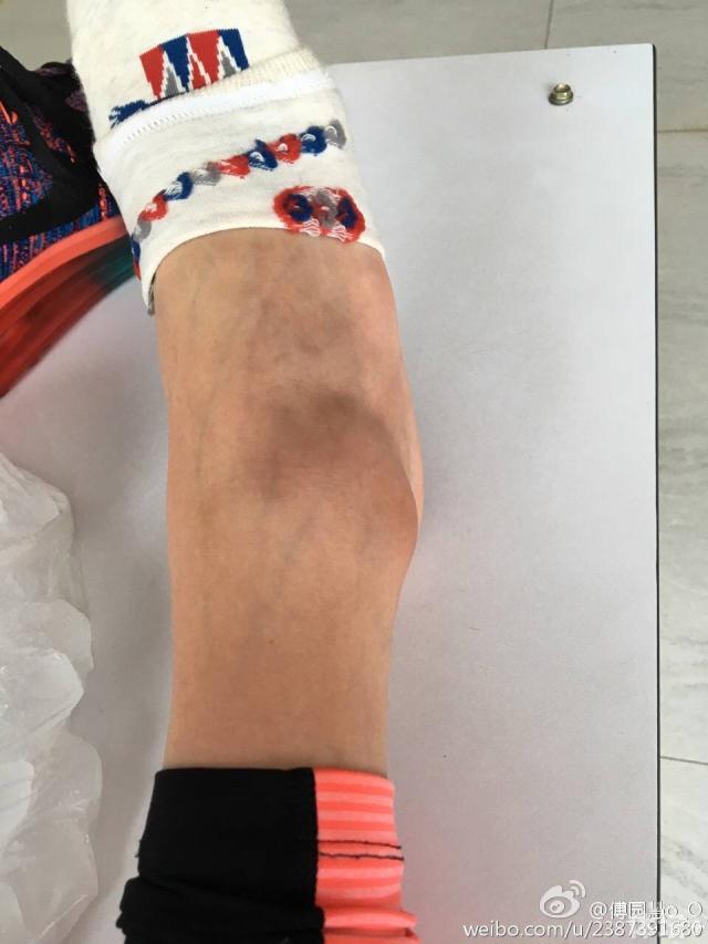 洪荒少女崴脚感叹不顺 网友直呼心疼盼其快快好