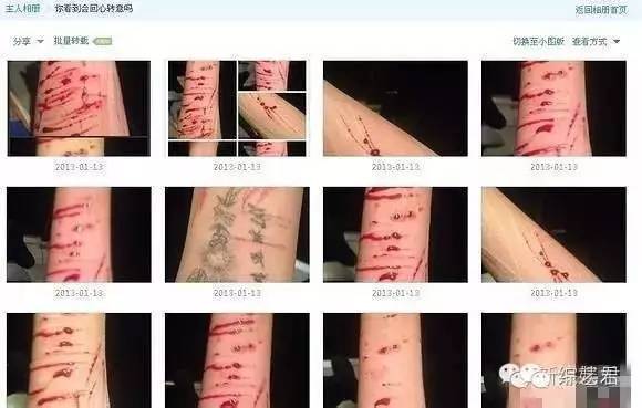 孩子变好肯定是件好事,但是不久后网上就有疑似李耐阅自残的照片出现!