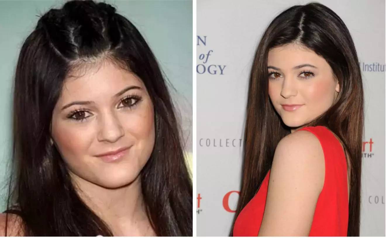 kylie jenner 公开承认自己打了丰唇针,小时候的她长这样,范姐觉得