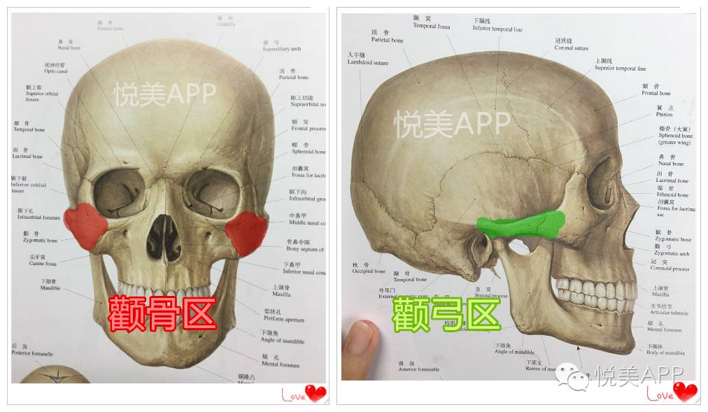 小脸术Ⅲ磨骨or截骨之颧骨手术来啦