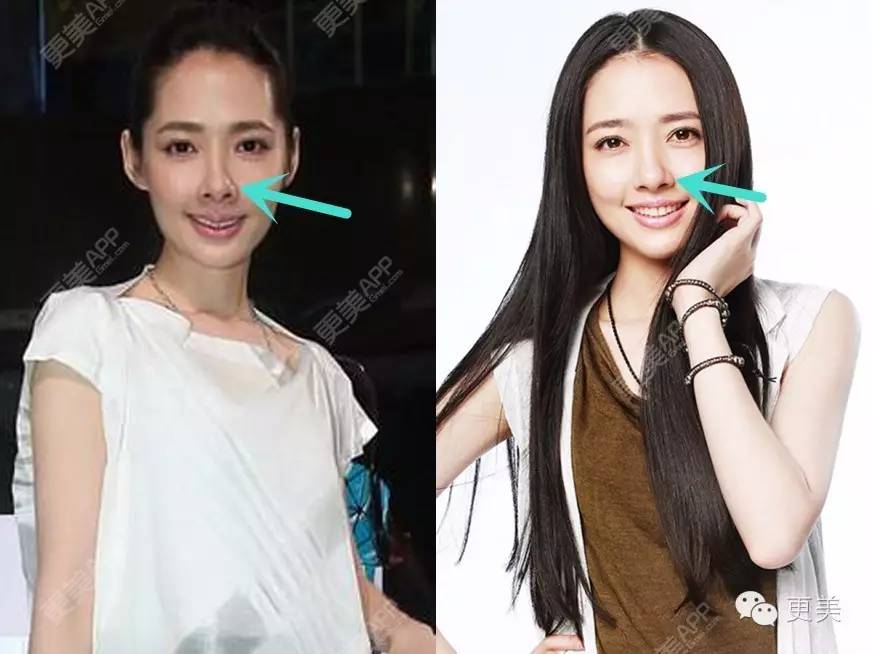 这些女星鼻孔里藏着一部整形史|鼻子|鼻孔|范冰冰_新浪女性_新浪网