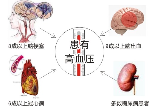 揭露“三高”真相:高血压、高血脂、高血糖!(请为父母收藏)__财经头条