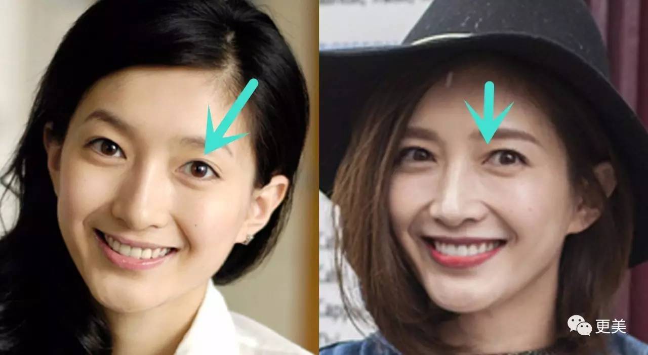 杨紫张歆艺长点心学学今年微整最成功的5位女星