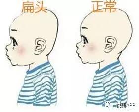 大宝贝你的脸大很可能是因为后脑勺扁