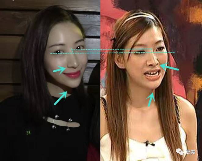 火星情报局变"整容局"!比沈梦辰还会整的她怎么都火不了