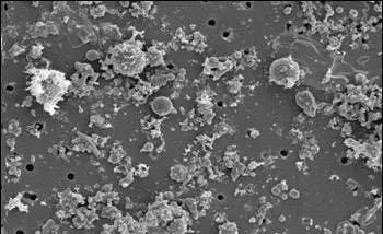 电子显微镜下的pm2.