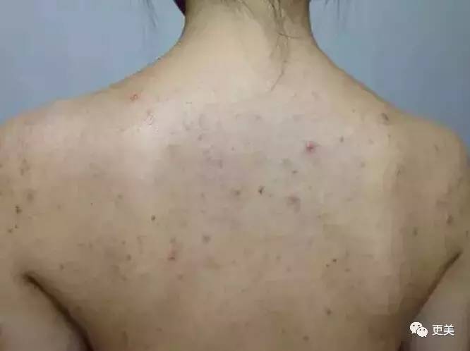 娱乐圈美背pk,倪妮最美而她却满后背肉