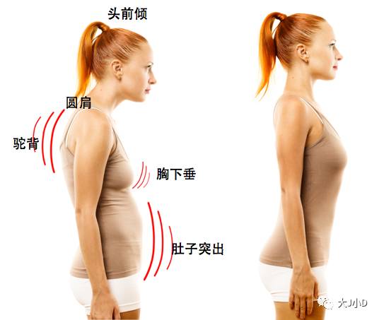 女人的衰老从体态开始告别老妈子姿势