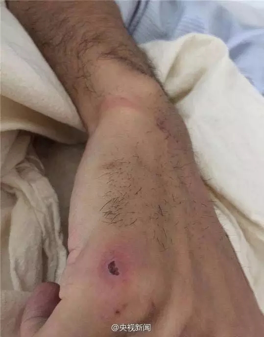 关注中国游客称在越南口岸被索要小费遭越边防人员殴打